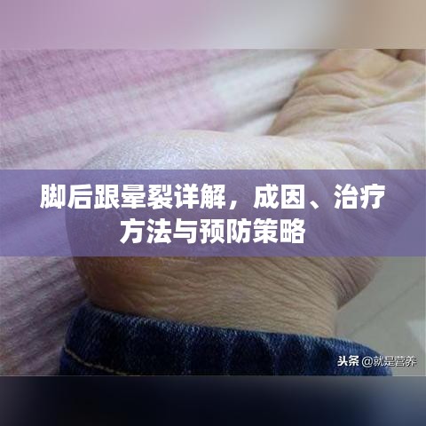 脚后跟晕裂详解，成因、治疗方法与预防策略